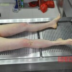 Initial examination of raped Chinese woman