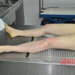 Initial examination of raped Chinese woman