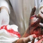 Chaharshanbe Soori injury