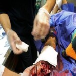 Chaharshanbe Soori injury