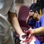 Chaharshanbe Soori injury