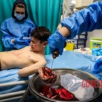 Chaharshanbe Soori injury