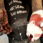 Chaharshanbe Soori injury