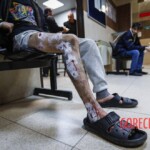 Chaharshanbe Soori injury