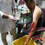 Chaharshanbe Soori injury