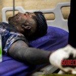 Chaharshanbe Soori injury