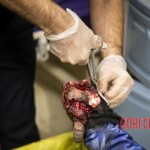 Chaharshanbe Soori injury