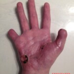 Chaharshanbe Soori injury