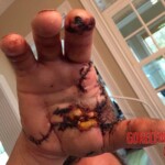 Chaharshanbe Soori injury