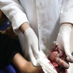 Chaharshanbe Soori injury