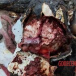 Postmortem examination of unidentified young woman