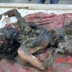 Postmortem examination of unidentified young woman