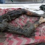 Postmortem examination of unidentified young woman