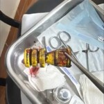 Woman is hit in face with rubber bullet