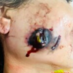 Woman is hit in face with rubber bullet