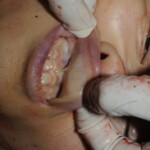 Autopsy of Chinese woman hacked with machete