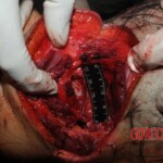 Autopsy of Chinese woman hacked with machete