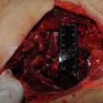 Autopsy of Chinese woman hacked with machete