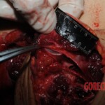 Autopsy of Chinese woman hacked with machete