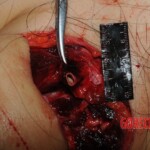 Autopsy of Chinese woman hacked with machete