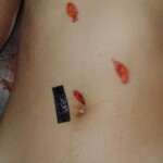 Autopsy of Chinese woman hacked with machete