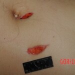 Autopsy of Chinese woman hacked with machete