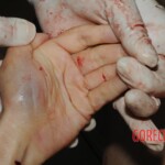 Autopsy of Chinese woman hacked with machete