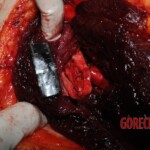 Autopsy of Chinese woman hacked with machete