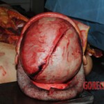 Autopsy of Chinese woman hacked with machete