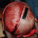 Autopsy of Chinese woman hacked with machete