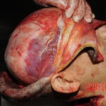 Autopsy of Chinese woman hacked with machete