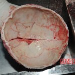 Autopsy of Chinese woman hacked with machete