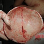 Autopsy of Chinese woman hacked with machete