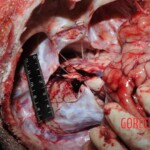 Autopsy of Chinese woman hacked with machete