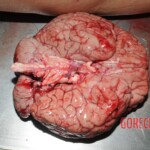 Autopsy of Chinese woman hacked with machete