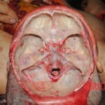 Autopsy of Chinese woman hacked with machete