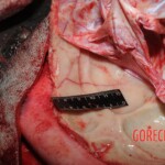 Autopsy of Chinese woman hacked with machete