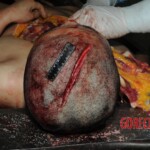 Autopsy of Chinese woman hacked with machete