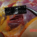 Autopsy of Chinese woman hacked with machete