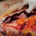 Autopsy of Chinese woman hacked with machete