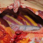 Autopsy of Chinese woman hacked with machete