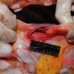 Autopsy of Chinese woman hacked with machete