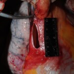 Autopsy of Chinese woman hacked with machete