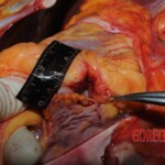 Autopsy of Chinese woman hacked with machete