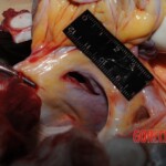 Autopsy of Chinese woman hacked with machete