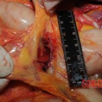 Autopsy of Chinese woman hacked with machete