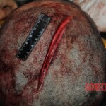 Autopsy of Chinese woman hacked with machete