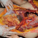 Autopsy of Chinese woman hacked with machete