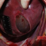 Autopsy of Chinese woman hacked with machete