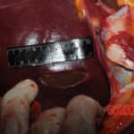 Autopsy of Chinese woman hacked with machete